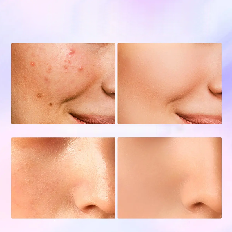 💄 50% DE RÉDUCTION 💖 Fond de teint crème longue tenue – SPF 30 & finition naturelle – Idéal pour une protection quotidienne – couvrant, confortable et lumineux ✨🌸🛡️